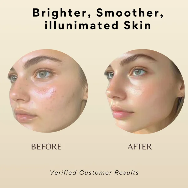 results for glass skin