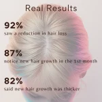 hair growth results with derma roller